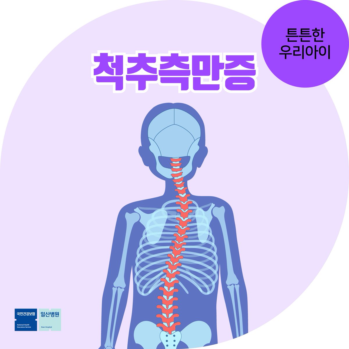 어깨 높이가 다르다면
의심해봐야 하는
#척추측만증 

주요 증상과 예방법
꼭! 확인해보세요!

▶️[튼튼한 우리아이] 어깨 높이 다르다면? 척추측만증 증상과 척추측만증 예방법
naver.me/G1IcHf1G

#일산병원
#척추측만증예방
#국민건강보험일산병원
