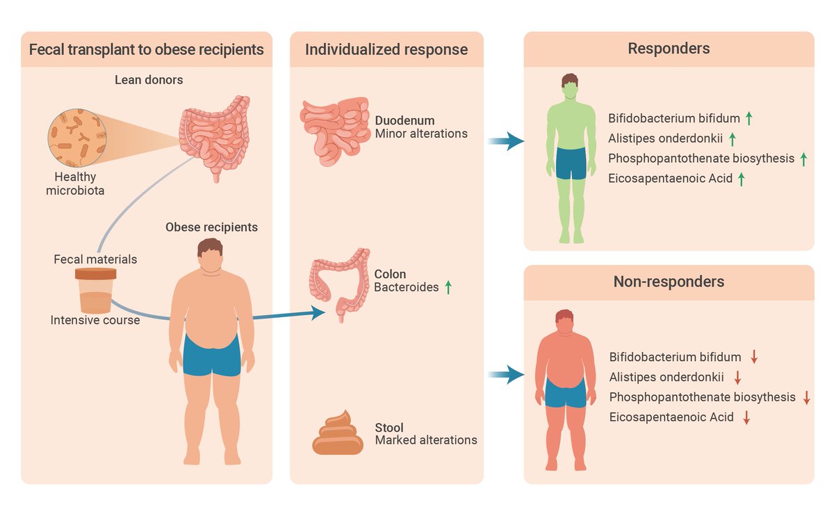 The_InnovationJ's tweet photo. Out now! Read our latest study regarding fecal #microbiota transplantation (FMT) on #obese individuals. Multi-omics analysis showed that specific bacteria and metabolic pathways were associated with #weightloss  after FMT. Read more
https://t.co/bNd6WqvOEF
#omics #Bioinformatics https://t.co/7x0zD8QJST