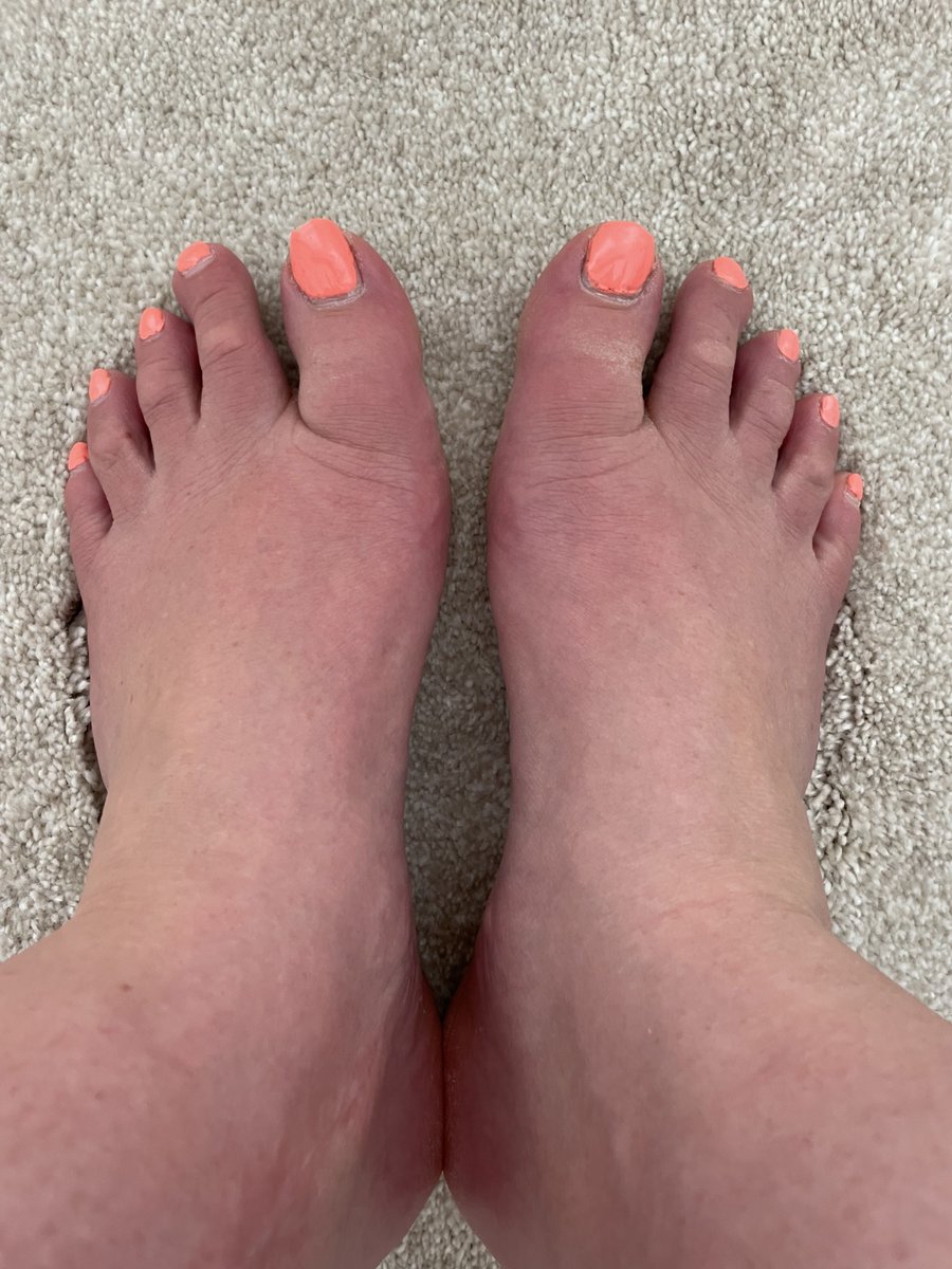 Would you cum on my feet?? #Feetlovers