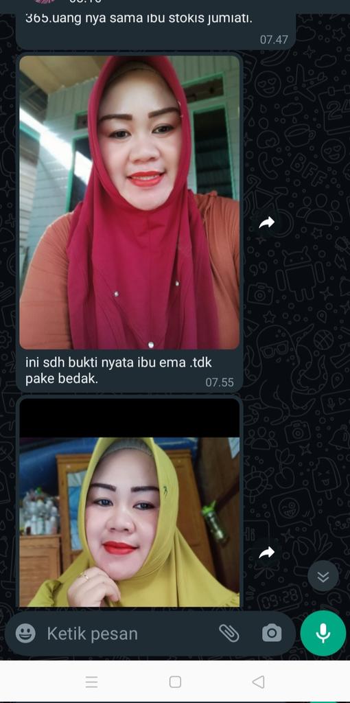 Muhamma59510434's tweet photo. Produk kecantikan ksehatan barangkali kita bisa bkerja sama say lagi nyari reseller tiap daerah salah satu bukti nyata dari produk say 081352483194 chat yah https://t.co/aFzPNjj08e