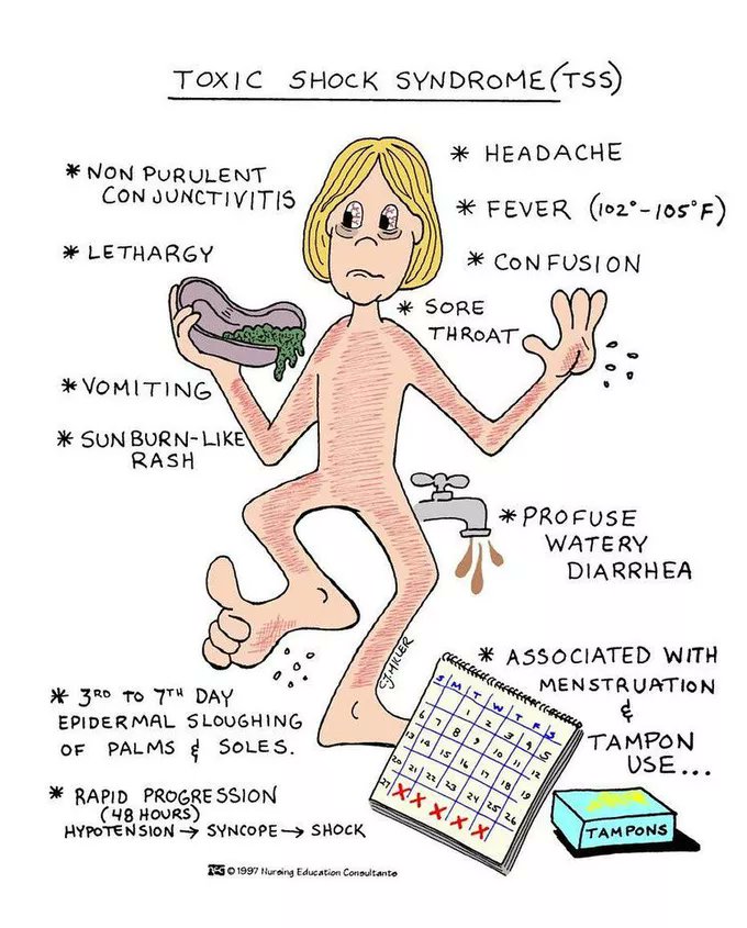 Journal of Brown Hospital Medicine on X: @InternAtWork Toxic shock syndrome  (doc wakeup) #IMpearls #Pediatrics #FOAMped  / X