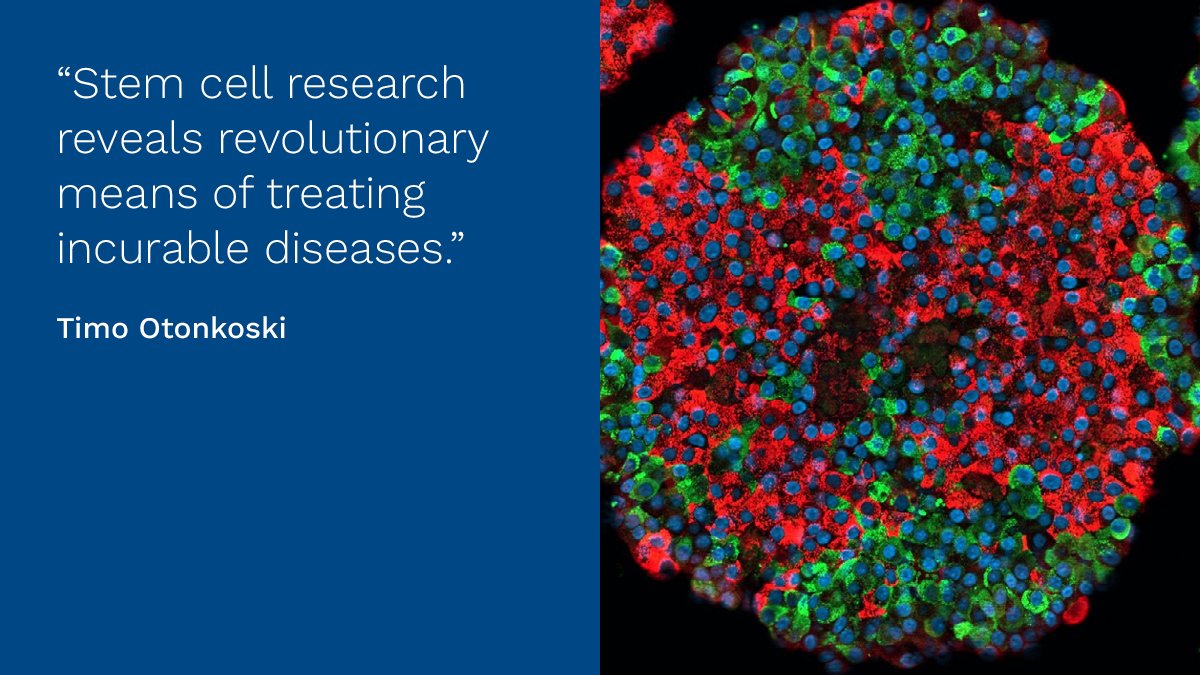 Sigrid Jusélius Stiftelse (@sigridjuselius) on Twitter photo Are stem cells the solution to incurable diseases? We asked top researchers how medicine will be revolutionized in the 2020s.
Read stem cell researcher <a href="/OtonkoskiT/">Timo Otonkoski</a> 's thoughts in the third and last part of the series: sigridjuselius.fi/en/news/a-deca…
#medicine #future Are stem cells the solution to incurable diseases? We asked top researchers how medicine will be revolutionized in the 2020s.
Read stem cell researcher <a href="/OtonkoskiT/">Timo Otonkoski</a> 's thoughts in the third and last part of the series: sigridjuselius.fi/en/news/a-deca…
#medicine #future