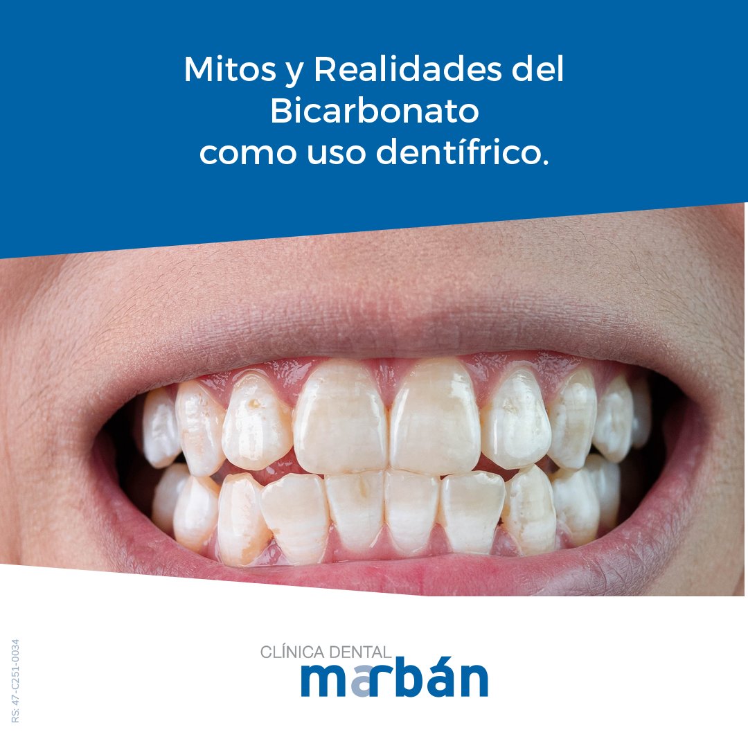 ⚠️ Mitos y realidades del bicarbonato ‼️ 
Mito: El bicarbonato blanquea los dientes.
Realidad: Antiguamente se utilizaba para ello, pero NO es recomendable ya que es muy abrasivo y ocasiona daños en el esmalte.

#ClinicaDeantalMarban #dientes #esmaltededientes #boca #bicarbonato