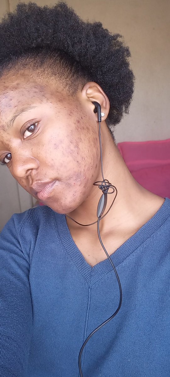 kgosigadi_mo's tweet photo. A little insight of what my life living with acne has been like 🧵🧵 https://t.co/m6vKhjgsw2