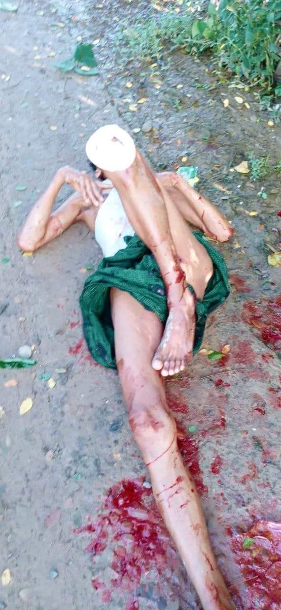 28.8.22,#MraukU.Rakhine Myanmar Military Kills in Indiscriminate attacks in #Arakan 3 civilians #died, 5 injured severely. 377th Battalion fire with heavy weapons landed in #Kinseink village , which killed 2 people including a (4)ys boy and  2 women.