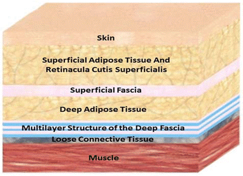samrad77's tweet photo. Review of fascial anatomy of lumbar perivertebral region. Illustration showing the middle thoracolumbar fascia (MTLF) and its sublayers; the MTLF contains 3 layers/lamina. The circle shows a magnified detailed image of the 3 layers of the MTLF. https://t.co/Z9LfGGfFE0