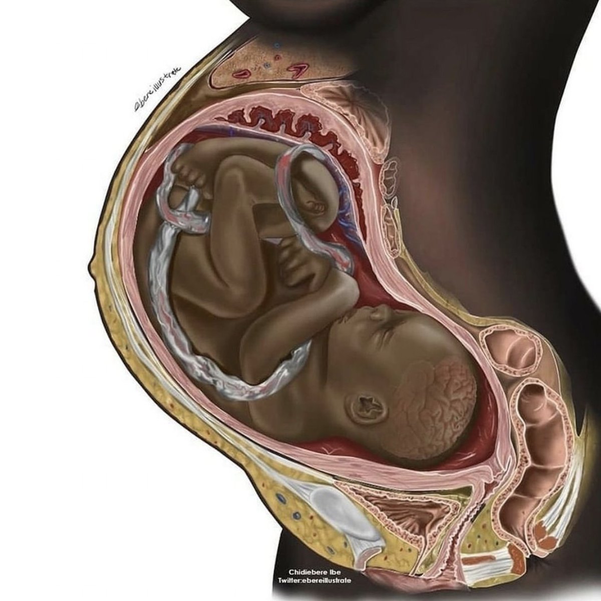 StudentsforLife's tweet photo. In mainstream textbooks, you just don't see Black pregnancy illustrated. 

Despite Planned Parenthood's best efforts, Black babies DO exist. And it's so nice to see them represented. https://t.co/uDzc9Pi9U3
