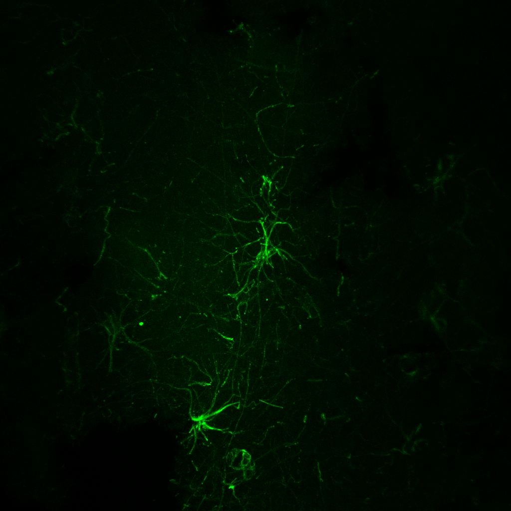 CarmenFalcone6's tweet photo. Cheers to the first immuno of the lab on GFAP+ cortical astrocytes in #chimpanzee and #tiger😍!

Credits for the images to @caterina_ciani and @Maricuz__ 

#FalconeLab #NewPI #astrocytes #evolution https://t.co/662CLLYfll
