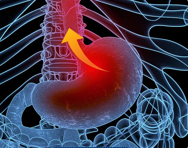 refluxraft tweet media