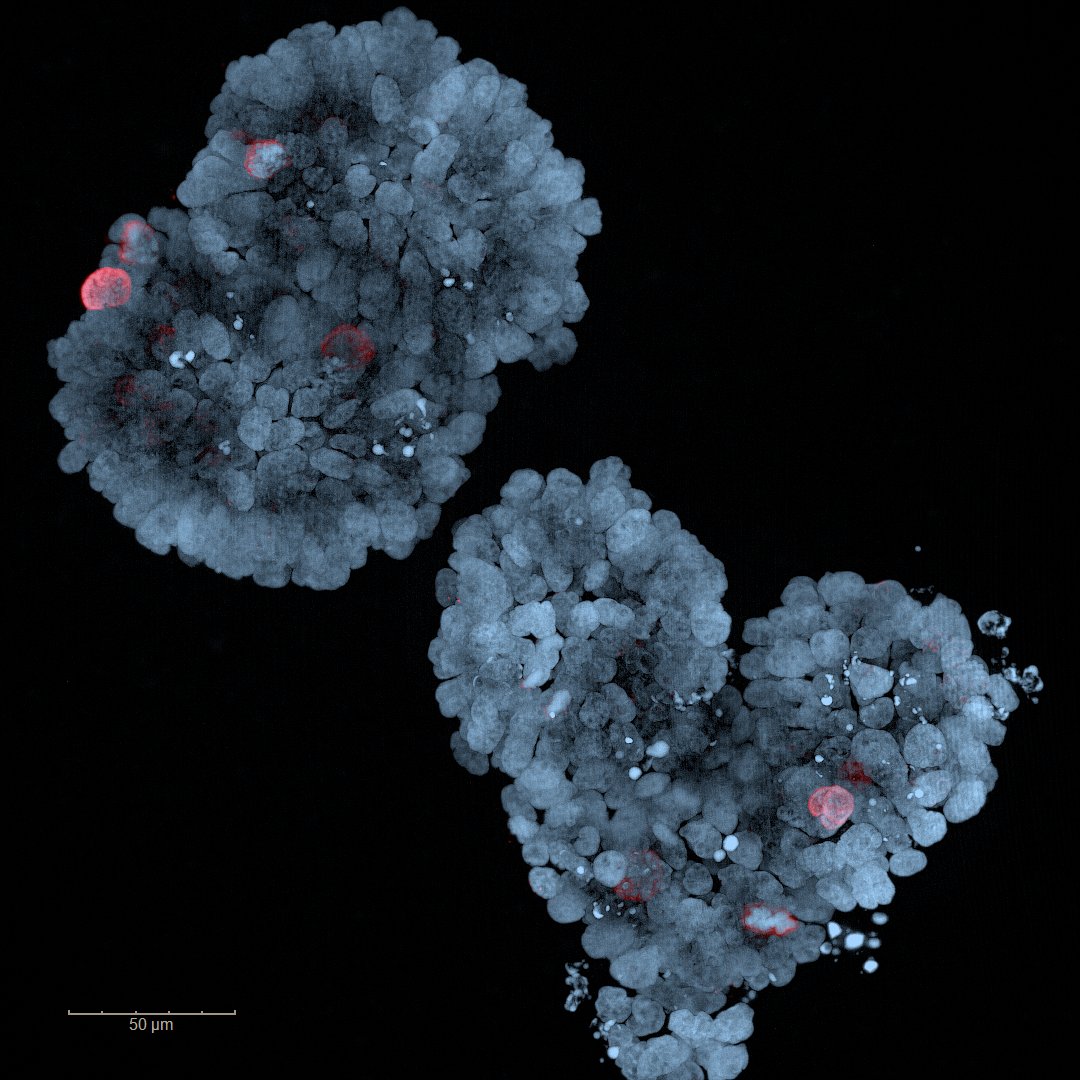 VolastraTx's tweet photo. When science is art: Check out this image of a colon cancer #organoid captured in our lab.  

We’re proud to partner with @WeillCornell to leverage organoids to study tumor biology in vitro, resulting in significantly improved models of patients’ tumors. #SciArt https://t.co/HxSGO7B1ip