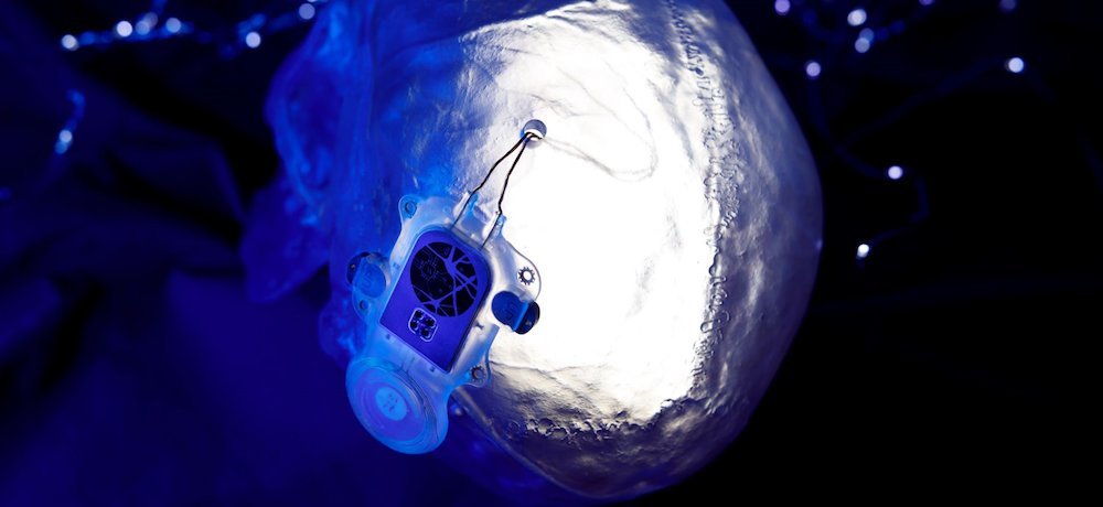 MedTechNow_'s tweet photo. #grants & awards
~@nihseed awards @avmbiotech #SBIRGrant =for #NonHodgkinsLymphoma research
~@nihseed awards #FeinsteinInstitutes $3.8M to study #radiation exposure & #sepsis
~@UMCUBrainCenter #researchers, @tugraz, @Wysscenter & @_CorTec_ receive @EUeic #EICPathfinder grant https://t.co/dTj3Aag0ln