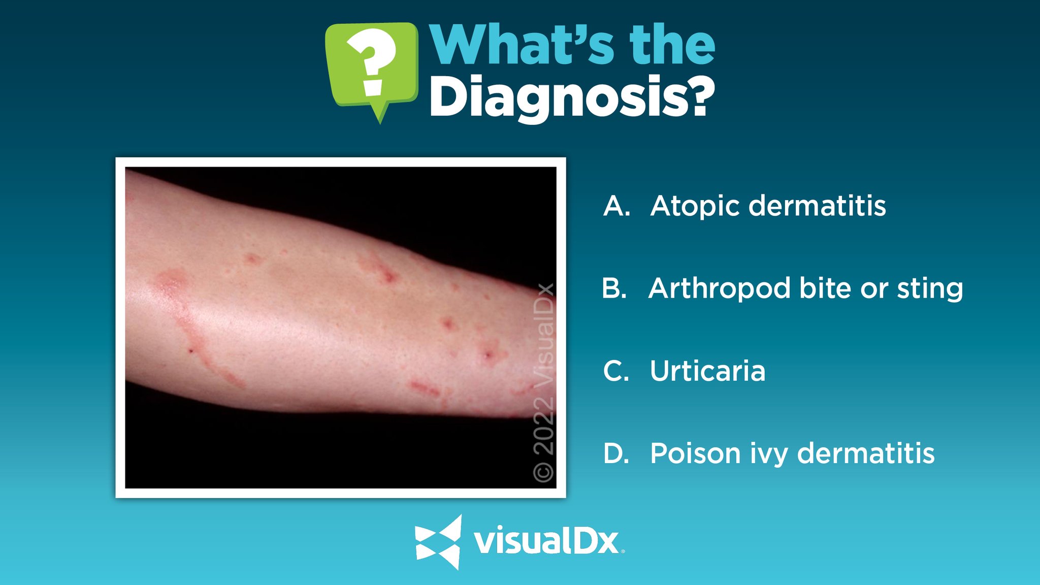 VisualDx on Twitter "What’s the Dx? 23 yo woman w/very pruritic rash that had developed on her