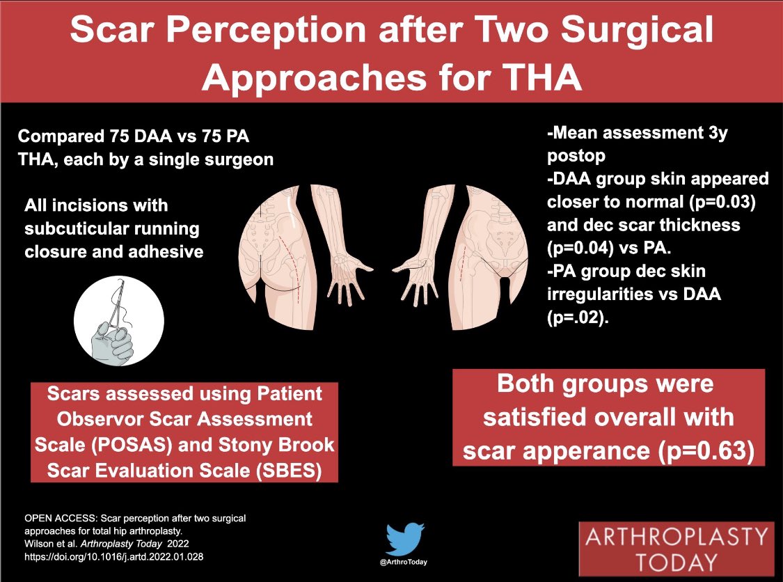Arthroplasty Today (@arthrotoday) on Twitter photo  Arthroplasty Today (@arthrotoday) on Twitter photo