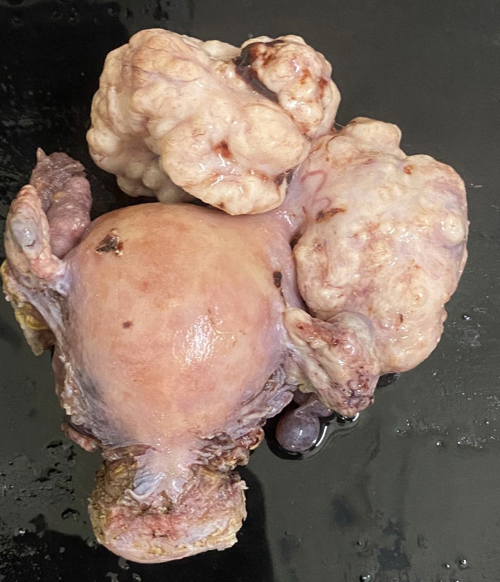 Gross diagnosis 

#PathTwitter