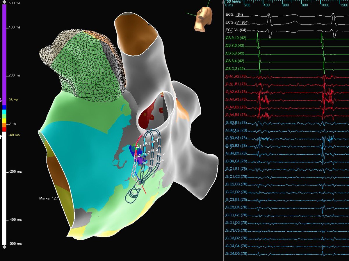 maddyferraro tweet media