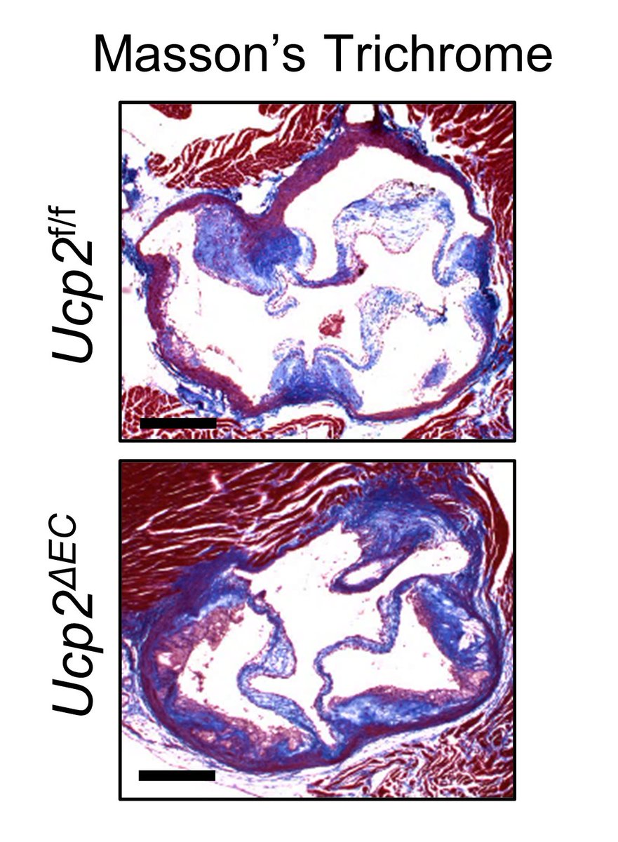 CircRes's tweet photo. Luo et al show that #UCP2 is novel mechanosensitive gene under the control of fluid shear stress & #KLF2 in endothelial cells. Learn how UCP2 expression is critical for endothelial #proinflammatory response & #atherogenesis at https://t.co/JmRyZCgR5p
@CityUHongKong https://t.co/SpVkqJxJkO