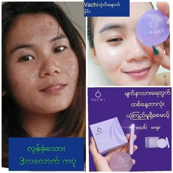 TfdTrrr's tweet photo. မဂ္​လာပါပစြည္​း​ေလး​ေတြအား​ေပက်ပါအုံသဲတုိဘန္​​ေဘာဖလန္​​ေဆာင္​အနီလူကုိယ္​တုိင္​ပုိ​ေပပါတယ္​ အခ်ာ​ေနရာ​ေတြက​ေတာအြန္​းလုိင္​းက​ေနပုိ​ေပပါတယ္​ ယုံၾကည္​မူအျပည္​နဲအား​ေပရပါတယ္​ခ်ိတုိ https://t.co/Xb9I7xt3OJ