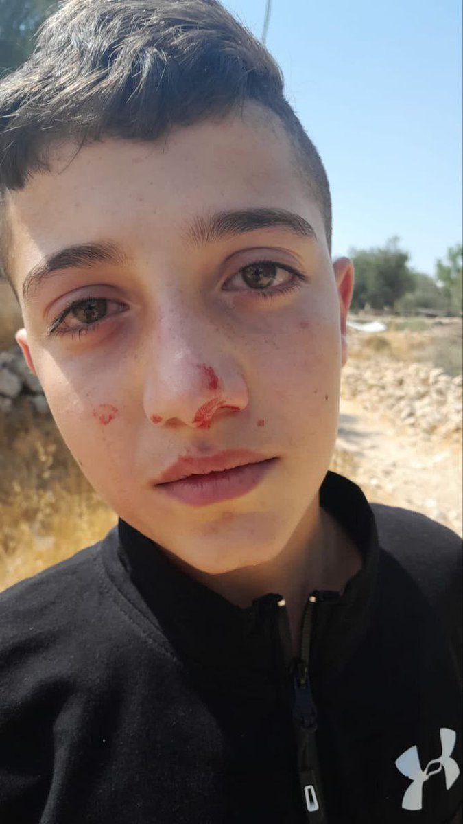 Timesofgaza's tweet photo. lsraeli settler beats up a Palestinian kid in Tel Rumeida, Hebron. https://t.co/p3tK2Tn9HV