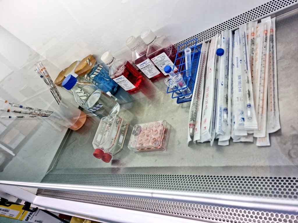 faisalsuliman4's tweet photo. I've spent my time during #bankholiday taking care of my #dysplastic and #cancer cells and 3Dmodels.

@PhDVoice
@thephdstory #BankHoliday #BankHolidayMonday  #PhDVoice 
#phdchat #phdlife #phdstudent https://t.co/9UUdpC0AAc