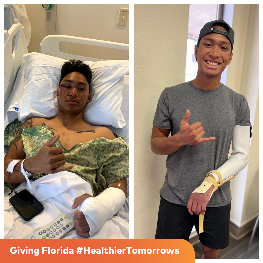 After a motorcycle accident, 22-year-old Cody Morales spent three weeks in physical therapy at HCA Florida Northwest Rehabilitation Center, a part of HCA Florida Fort Walton-Destin Hospital​. Now on the road to recovery, Cody feels lucky to be alive. #HealthierTomorrows