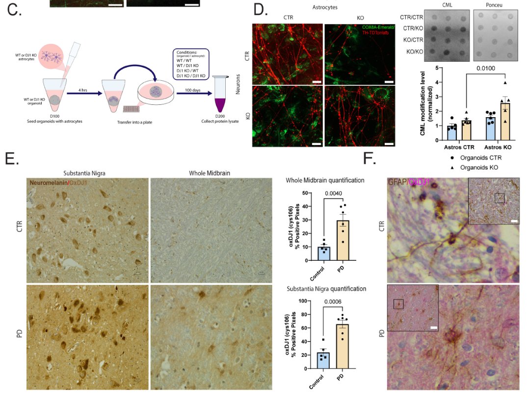 ScienceofPD's tweet photo. New @biorxivpreprint manuscript from @AhfeldtTim &amp; colleagues use iPSC-derived midbrain organoid models to show that lots of stuff goes wrong in the absence of #Parkinsons-associated DJ1, &amp; astrocytes are the master of ceremonies
https://t.co/THwExNV9Jr https://t.co/KLaNwiTgE1