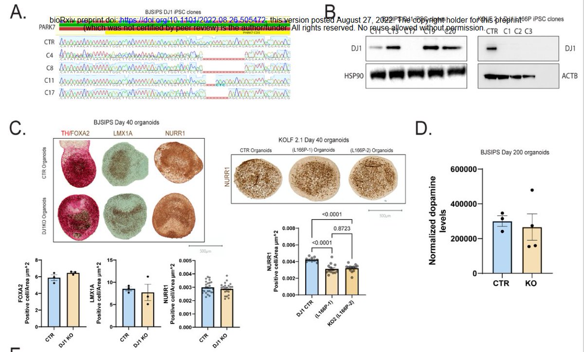 ScienceofPD's tweet photo. New @biorxivpreprint manuscript from @AhfeldtTim &amp; colleagues use iPSC-derived midbrain organoid models to show that lots of stuff goes wrong in the absence of #Parkinsons-associated DJ1, &amp; astrocytes are the master of ceremonies
https://t.co/THwExNV9Jr https://t.co/KLaNwiTgE1