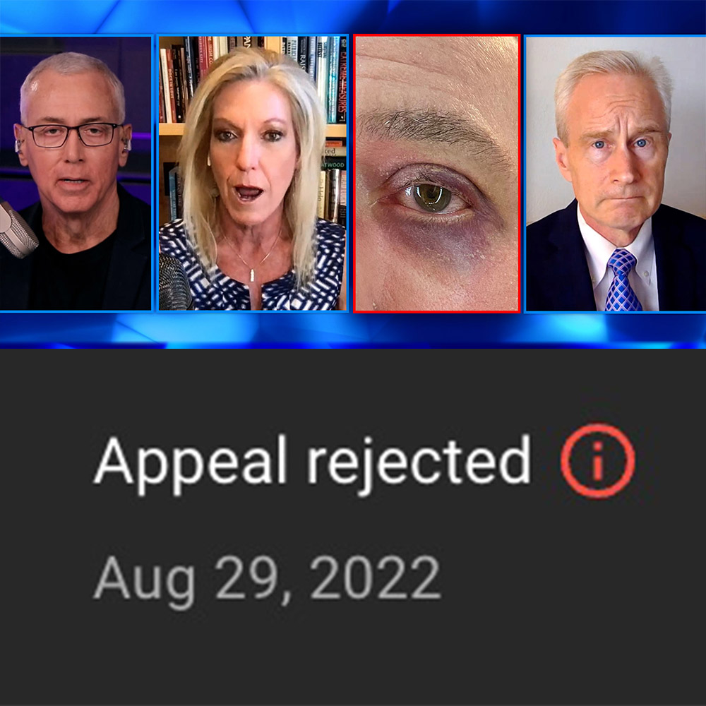 Dr. Drew on Twitter: "Here we go again. @TeamYouTube put another strike on  my channel because I showed an unedited pic of my spontaneous raccoon eye  after my J&amp;J vaccine. I even