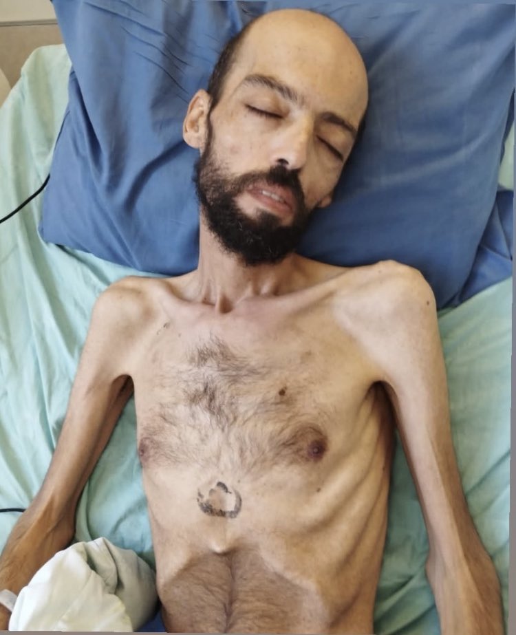 After 6 months on hunger strike, in protest against his administrative detention, without charge or trial, the conditions of Palestinian citizen Khalil Awawdad are getting worse every day. #Palestinian #Palestine #ApartheidIsrael