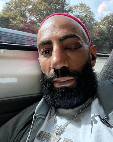 Armxnk's tweet image. One eye open when im sleeping