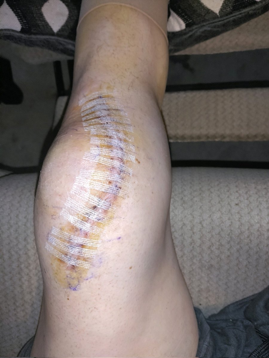 Thank God, I'm getting better