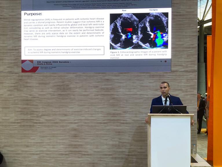 It was a pleasure to present my first abstract at ESC Congress 2022 in Barcelona about isometric handgrip exercise testing in patients with ischemic MR. #ESCCongress #Cardiotwitter 
Thank you for my research group!
<a href="/RalfWestenfeld/">Ralf Westenfeld</a> <a href="/Max_Spieker/">Maximilian Spieker</a> @HannahLagarden <a href="/YoungDgk/">Young DGK</a>