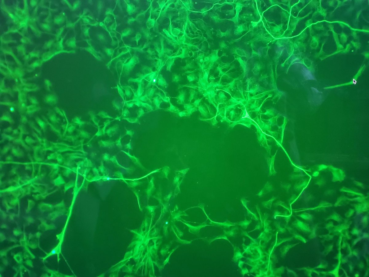 Karen Litwa (@brain_maker) on Twitter photo 1 week in and already the students in the microscopy course are taking beautiful images! <a href="/ECU_Biology/">ECU_Biology</a> 1 week in and already the students in the microscopy course are taking beautiful images! <a href="/ECU_Biology/">ECU_Biology</a>