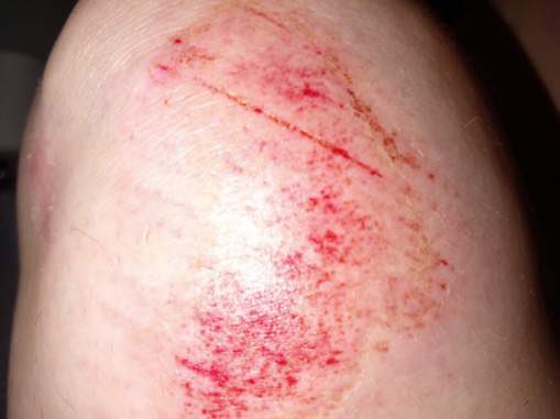 Imagineme32's tweet photo. @LadySariel666 @AnneofKingston @CKWS_TV @SteveScho54 Here is the 5’2 wife who was attacked by a 6’4 man and thrown to the pavement by her hair https://t.co/XmUIRr475j