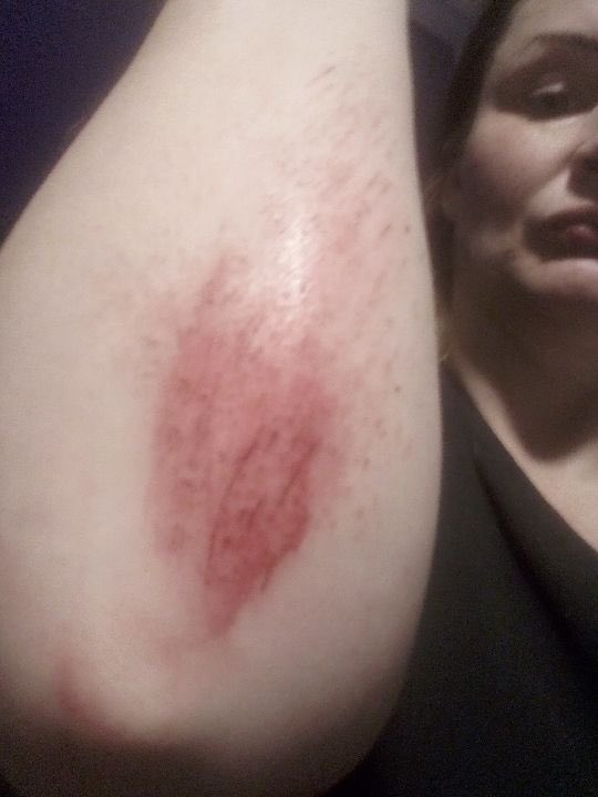 Imagineme32's tweet photo. @LadySariel666 @AnneofKingston @CKWS_TV @SteveScho54 Here is the 5’2 wife who was attacked by a 6’4 man and thrown to the pavement by her hair https://t.co/XmUIRr475j
