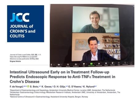 ign76's tweet photo. 📡 The Journal of Crohn´s and Colitis #JCC Podcast is back!
🔵 Thanks to @ECCONews @Y_ECCO_IBD for the invitation to host this chat about:
Intestinal Ultrasound as an early predictor of TNFi response in Crohn´s with 💫 @DeVoogdFloris from Amsterdam UMC! 🎙️
Very fun!👍 @my_ueg https://t.co/n7RaXEihAe
