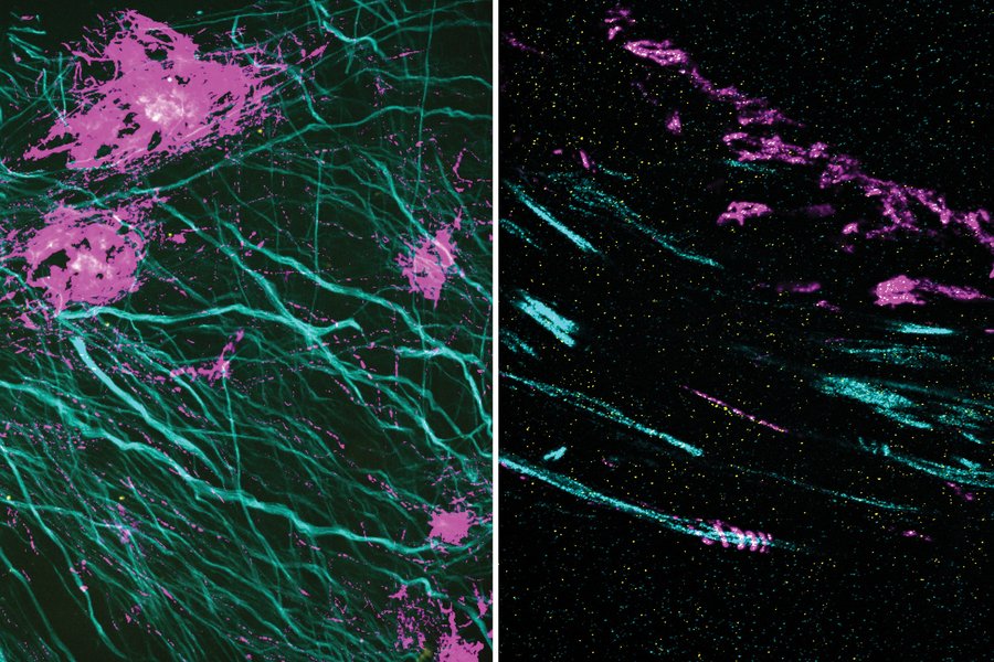 Researchers leverage the inherent “de-crowding” of intracellular components by #SuperResolution expansion #Microscopy #ExM, adapting the technique to label after the expansion step, providing better access to label difficult-to-reach cellular structures: go.nature.com/3pU61k5