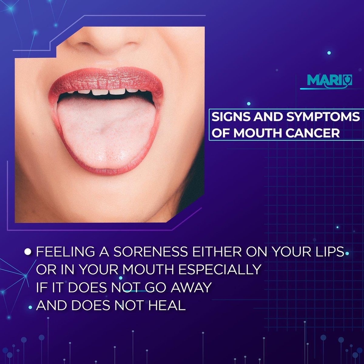 mari_research's tweet photo. The Cause of Mouth cancer
When either on the lips or any other area in the mouth, cancerous cells start to grow rapidly and bring mutations in the DNA. #MARI #mouthcancer #lifestyle #misdiagnosis #healthcare https://t.co/WCQVcETnOt