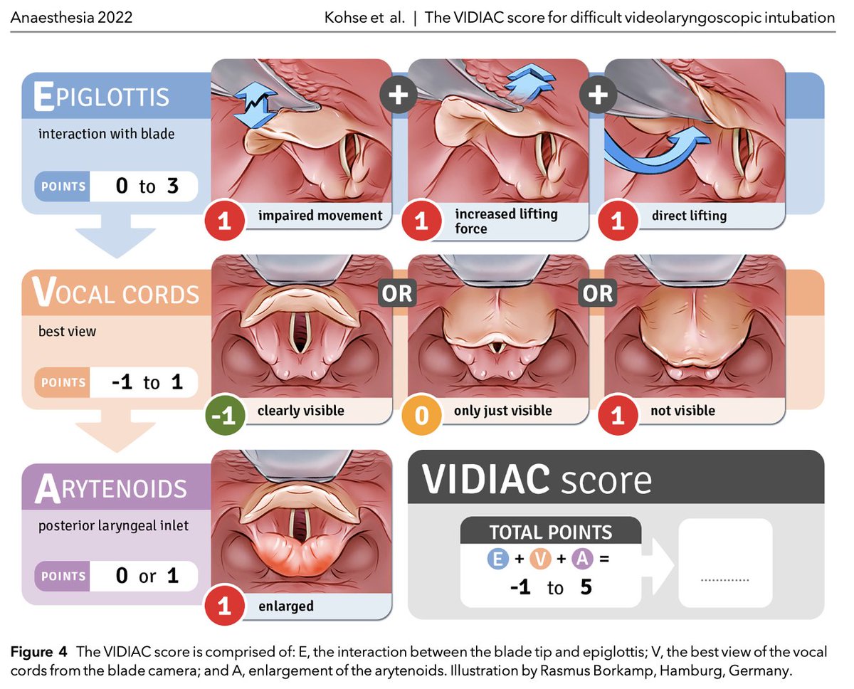 🔐This new prospective study was able to develop a multivariable lasso regression model and simplified VIDIAC score that associates videolaryngoscopic intubation characteristics with subsequent issuing of a difficult airway alert.

#OpenAccess

🔗…-publications.onlinelibrary.wiley.com/doi/10.1111/an…