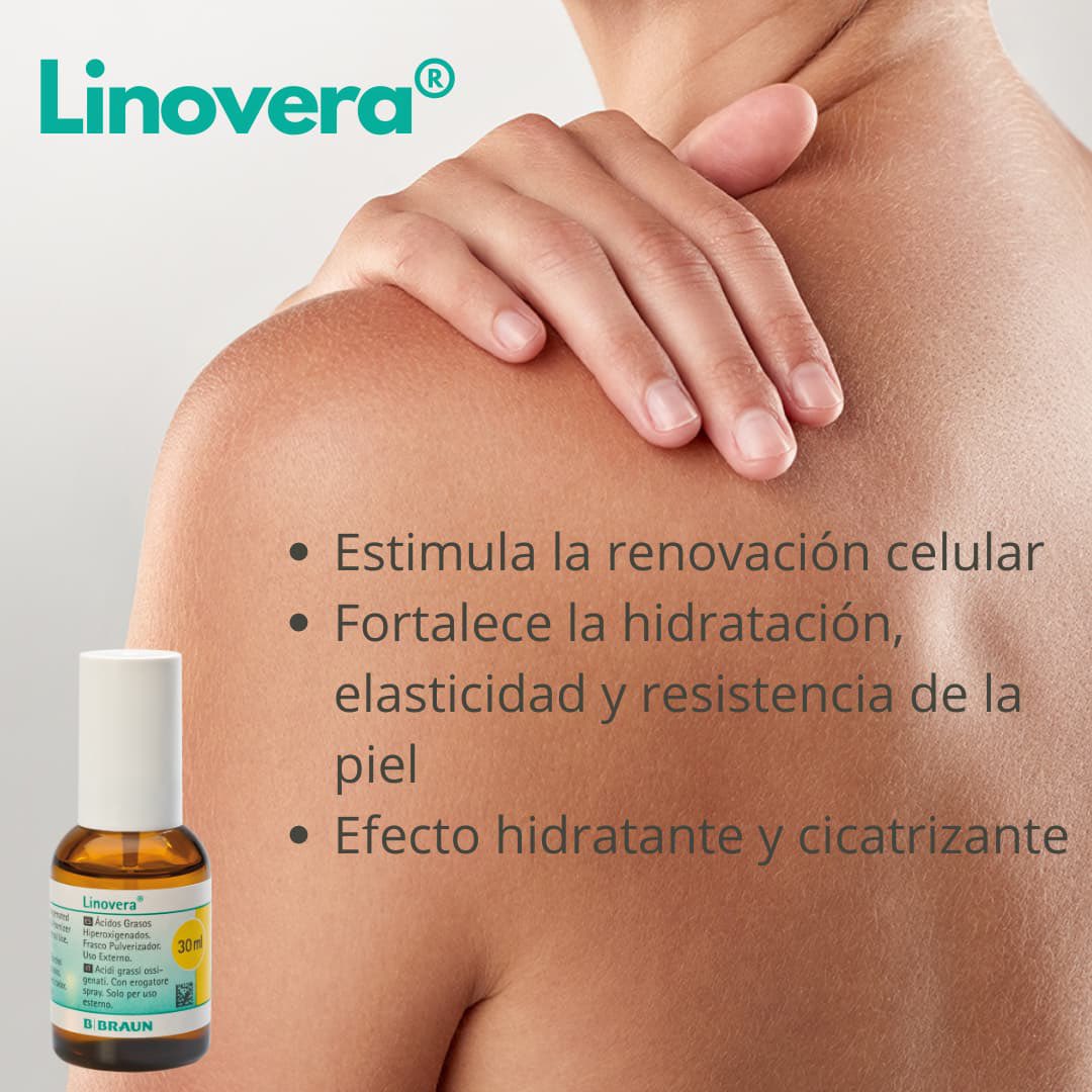 UlcerasMexico's tweet photo. y tú ¿ya conoces como #Linovera ayuda a cuidar tu piel?
@BBraunMx
https://t.co/SXssPqjI56 https://t.co/lEQZJWhhn5