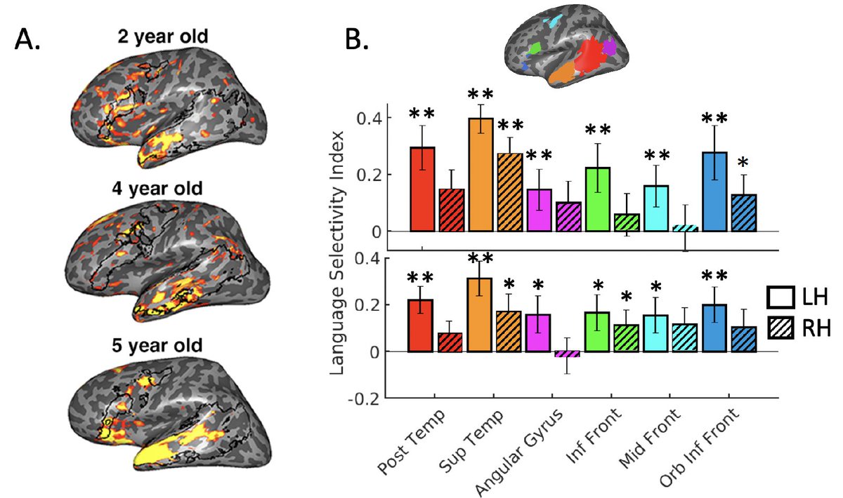 Zeynep Saygin | zeynepsaygin.bsky.social (@z_saygin) on Twitter photo We scanned 2-9 year olds x-sectionally & longitudinally on auditory language task and on spatial working memory task (modified from <a href="/ev_fedorenko/">Ev (like in 'evidence', not Eve) Fedorenko 🇺🇦</a>). Even young kids show robust & left-lateralized selectivity to spoken language (vs. 2 control conditions) in frontal & temporal fROIs We scanned 2-9 year olds x-sectionally & longitudinally on auditory language task and on spatial working memory task (modified from <a href="/ev_fedorenko/">Ev (like in 'evidence', not Eve) Fedorenko 🇺🇦</a>). Even young kids show robust & left-lateralized selectivity to spoken language (vs. 2 control conditions) in frontal & temporal fROIs