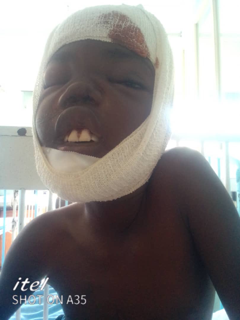 daddyhope's tweet photo. This is Blessing Mhondiwa, a victim of a Hippo attack.

He has been discharged from Harare Hospital, but he needs restorative surgery.

I am told Harare Hospital won't release him unless he pays Z$173,000.

Where did a similar story happen and ZANUPF shed crocodile tears? https://t.co/16npbfzGma