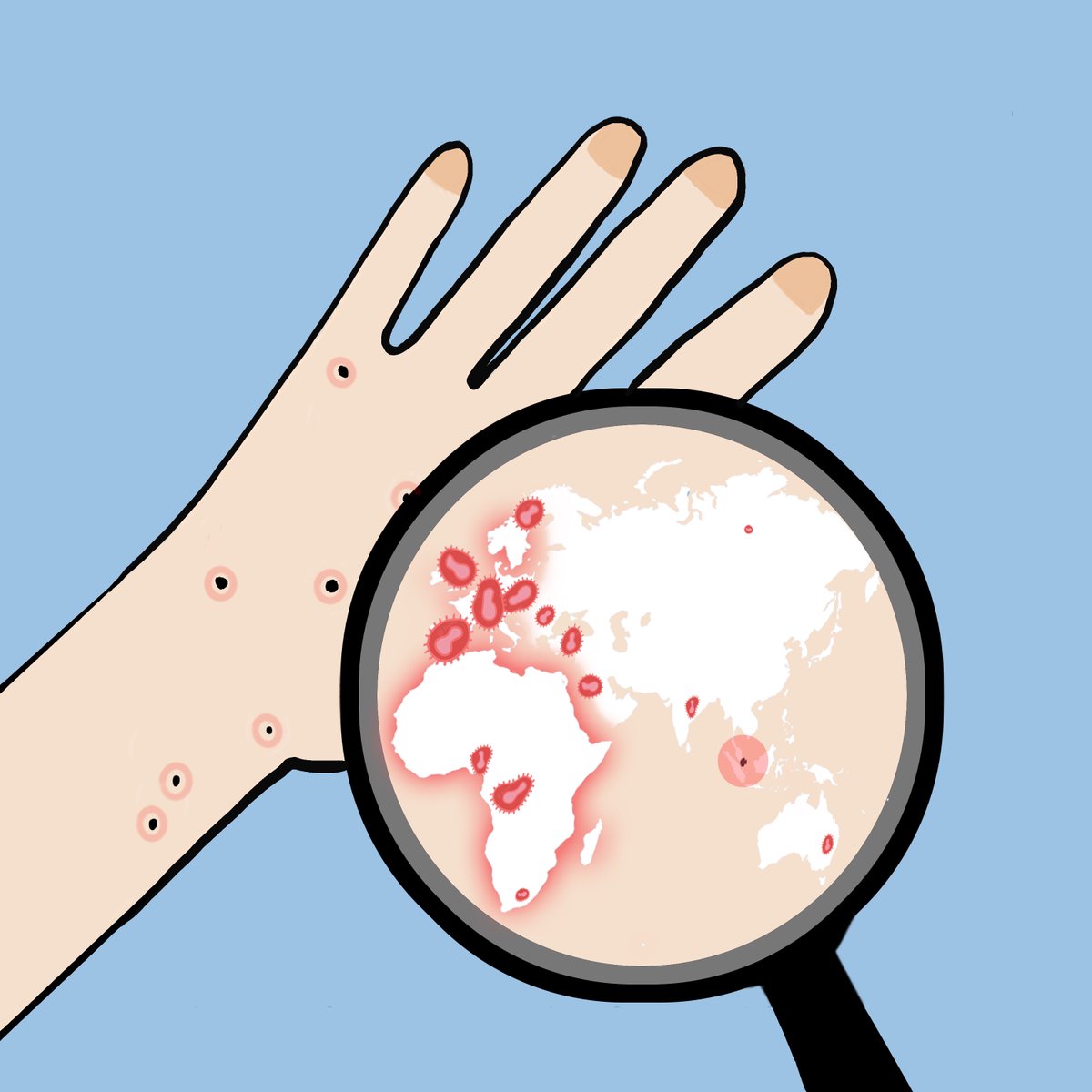 AnnalsSG's tweet photo. Global #monkeypox outbreak 2022 and the first case series in #Singapore, interaction of #sex and #diabetes in patients with #heartfailure, characteristics of frequent attenders to multiple #EmergencyDepartments, and more.

Read the August issue: https://t.co/iBXc9YXcb5 https://t.co/A8QqyAD3le