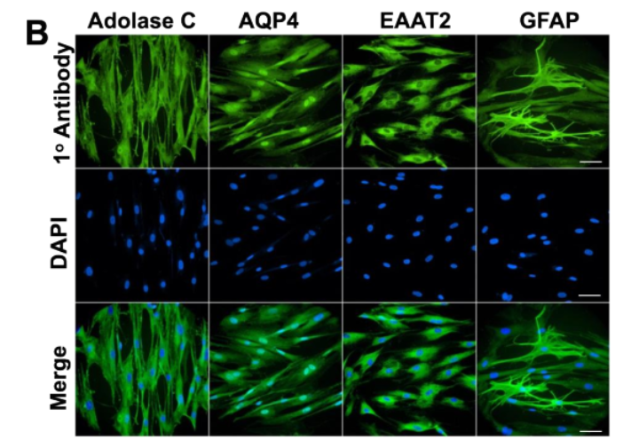 GeroScienceAGE's tweet photo. 📢Recommended Methods🔬Paper 
#primaryneuron and #Astrocyte cultures from postnatal #Callithrixjacchus: a #nonhumanprimate in vitro model for research in #neuroscience, #nervoussystem #aging, and #neurologicaldiseases of aging.
https://t.co/FSKTbXfhaX
@UTHealthSA https://t.co/oSxRLrggd7