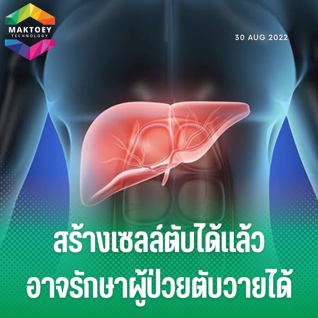 Maktoejjj's tweet photo. บริษัท #LyGenesis ซึ่งมีสำนักงานใหญ่ในเมือง Pittsburgh ของสหรัฐฯกำลังจะเริ่มการทดลองใช้เซลล์ตับของผู้บริจาคที่มีสุขภาพดีฉีดเข้าไปในต่อมน้ำเหลืองของผู้ป่วยโรคตับระยะสุดท้ายเพื่อเพาะปลูก “#ตับจิ๋ว” ซึ่งเป็นอวัยวะขนาดเล็กขึ้นในต่อมน้ำเหลืองที่มีอยู่หลายจุดทั่วร่างกาย
#maktoeyTV https://t.co/8GOrvuwjID