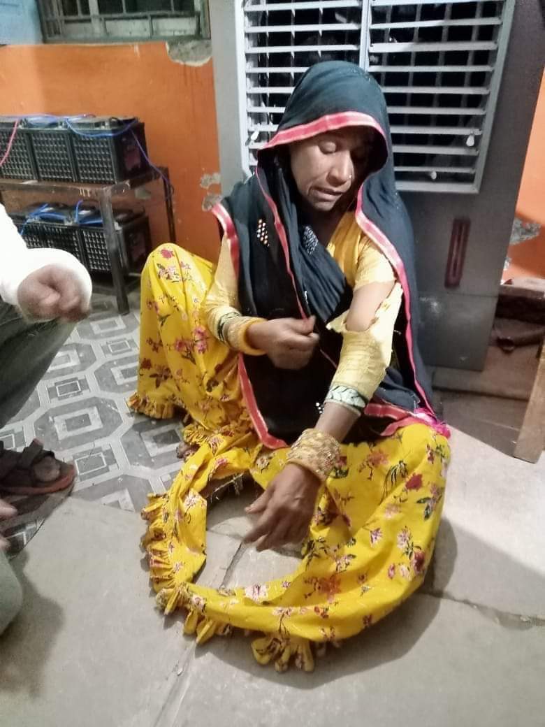 मध्यप्रदेश के रतलाम जिले के रावटी में एक आदिवासी महिला को गो रक्षा के नाम पर बुरी तरह पीटा गया, कब तक गो रक्षा के नाम पर निर्दोष पालतू  पशुओं को पालने वाले लोगों को मारा जाएगा ।।
<a href="/anandrai177/">Office Of Dr Anand Rai</a> <a href="/HansrajMeena/">Hansraj Meena</a>