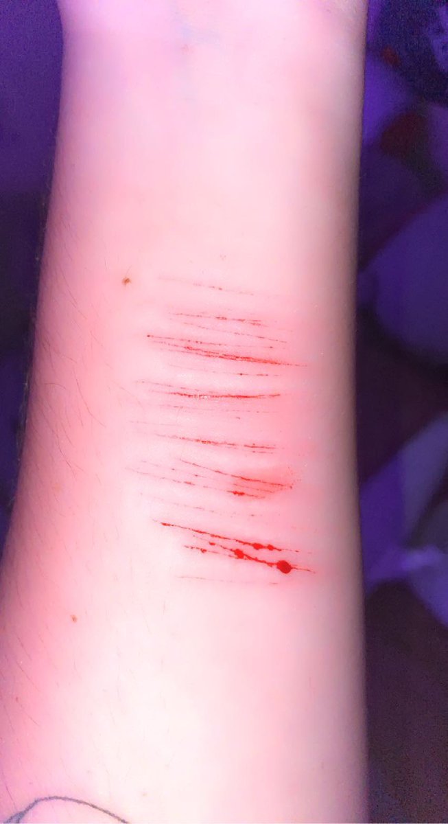 YRPSYCHOBF's tweet photo. did my pretty little wrist !!! <333 https://t.co/PyhKHR5by2