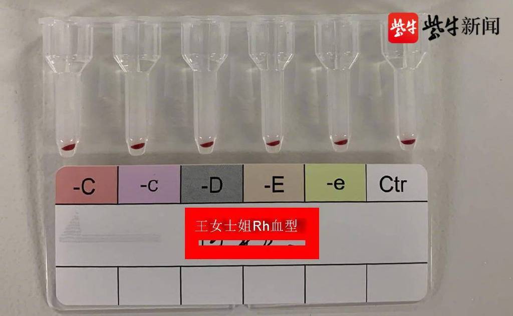 shanghaidaily's tweet photo. A pair of sisters in #Jiangsu Province have recently tested to have #Rhnull blood, one of the rarest and most precious blood types in the world, when one of them went to hospital for the treatment of severe anemia. Rhnull blood is known as golden blood for its rarity. https://t.co/i4uetRPITp