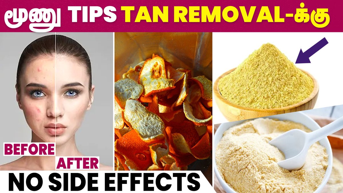 IbcMangai's tweet image. How to Remove Sun Tan Naturally? | Sun Tan Home Remedies | Skin Care | IBC Mangai

WATCH NOW --&amp;gt; youtu.be/sCYzR2tIcEQ

#suntan #removesuntan #tanremoval #homeremedies #skincare #ibcmangai