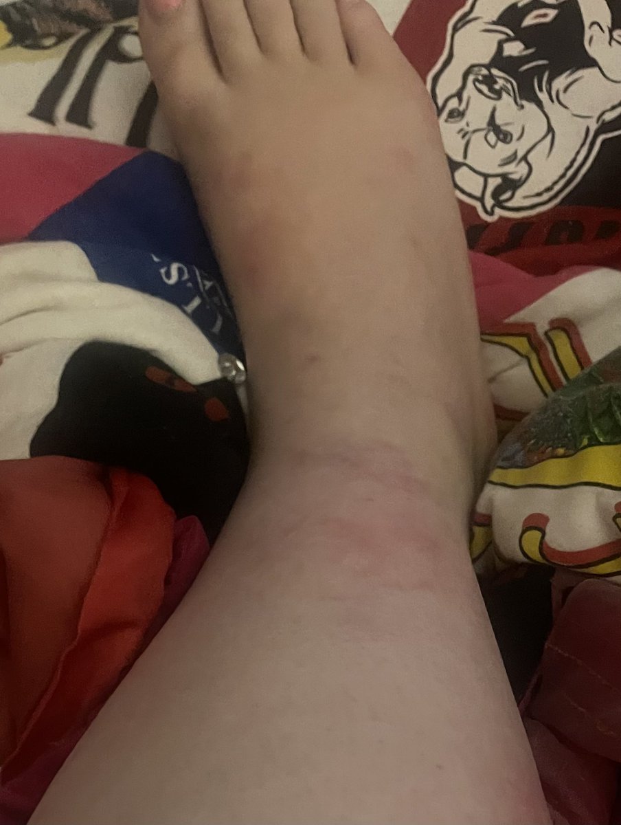 Satan is definitely alive because mosquitos are so evil that they have to be employed by Satan there is no other explanation