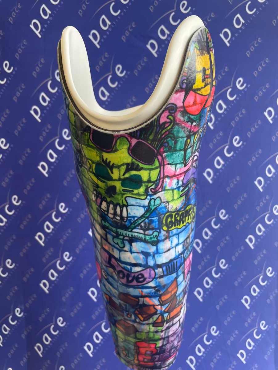 PaceRehab's tweet photo. Colourful socket design by Pace technician @bexyearworth
#prothetics #socket #rehabilitation #pacerehab #technicianoftheyear2022 https://t.co/g7kXuO0O91